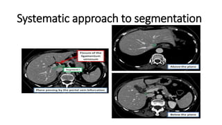 Systematic approach to segmentation
 