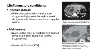 Hepatobiliary Imaging.pptx