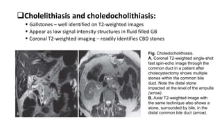 Hepatobiliary Imaging.pptx