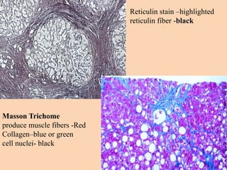 Masson Trichome
produce muscle fibers -Red
Collagen–blue or green
cell nuclei- black
Reticulin stain –highlighted
reticulin fiber -black
 