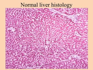 Normal liver histology
 