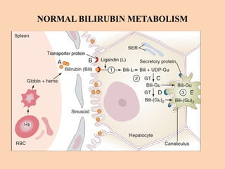 NORMAL BILIRUBIN METABOLISM
 