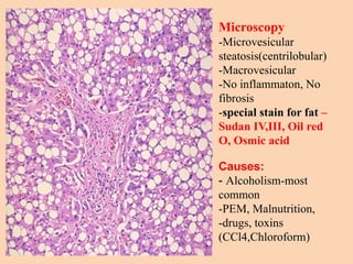 Microscopy
-Microvesicular
steatosis(centrilobular)
-Macrovesicular
-No inflammaton, No
fibrosis
-special stain for fat –
Sudan IV,III, Oil red
O, Osmic acid
Causes:
- Alcoholism-most
common
-PEM, Malnutrition,
-drugs, toxins
(CCl4,Chloroform)
 