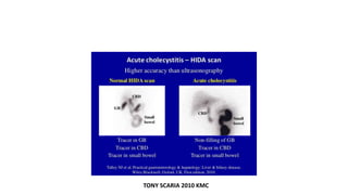 TONY SCARIA 2010 KMC
 