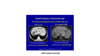 TONY SCARIA 2010 KMC
 