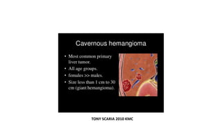 TONY SCARIA 2010 KMC
 