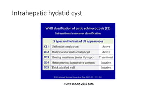 Intrahepatic hydatid cyst
TONY SCARIA 2010 KMC
 