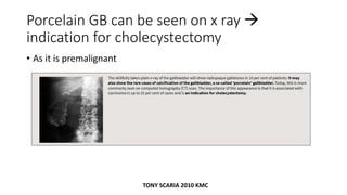 Porcelain GB can be seen on x ray 
indication for cholecystectomy
• As it is premalignant
TONY SCARIA 2010 KMC
 