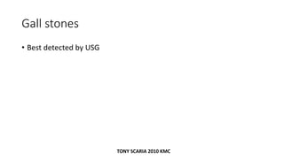 Gall stones
• Best detected by USG
TONY SCARIA 2010 KMC
 