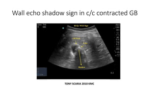 Wall echo shadow sign in c/c contracted GB
TONY SCARIA 2010 KMC
 