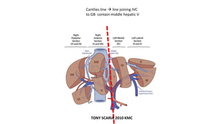 Cantlies line  line joining IVC
to GB contain middle hepatic V
TONY SCARIA 2010 KMC
 