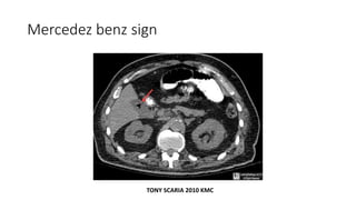 Mercedez benz sign
TONY SCARIA 2010 KMC
 