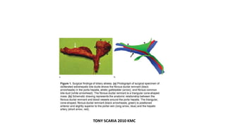 TONY SCARIA 2010 KMC
 