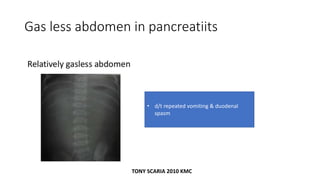 Gas less abdomen in pancreatiits
• d/t repeated vomiting & duodenal
spasm
TONY SCARIA 2010 KMC
 