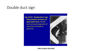 Double duct sign
TONY SCARIA 2010 KMC
 