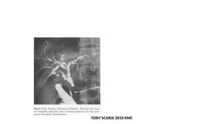 TONY SCARIA 2010 KMC
 