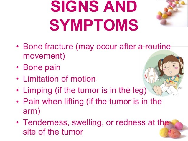 bone cancer in leg what are the symptoms bone cancer in leg what are the symptoms