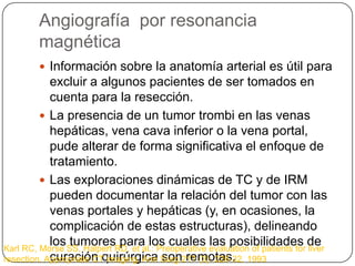 Angiografía por resonancia
         magnética
          Información sobre la anatomía arterial es útil para
            excluir a algunos pacientes de ser tomados en
            cuenta para la resección.
          La presencia de un tumor trombi en las venas
            hepáticas, vena cava inferior o la vena portal,
            pude alterar de forma significativa el enfoque de
            tratamiento.
          Las exploraciones dinámicas de TC y de IRM
            pueden documentar la relación del tumor con las
            venas portales y hepáticas (y, en ocasiones, la
            complicación de estas estructuras), delineando
            los tumores para los cuales las posibilidades de
Karl RC, Morse SS, Halpert RD, et al.: Preoperative evaluation of patients for liver
            curación quirúrgica son remotas.
resection. Appropriate CT imaging. Ann Surg 217 (3): 226-32, 1993
 