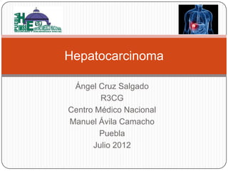Hepatocarcinoma

 Ángel Cruz Salgado
        R3CG
Centro Médico Nacional
Manuel Ávila Camacho
        Puebla
      Julio 2012
 