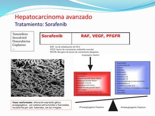 Hepatocarcinoma avanzado
Tratamiento: Sorafenib
Sorafenib RAF, VEGF, PFGFR
Tamoxifeno
Seocalcitol
Doxorubicina
Cisplatino
…
RAF: vía de señalización de HCC
VEGF: factor de crecimiento endotelio vascular
PFGFR: Receptor de factor de crecimiento plaquetas
Vasos neoformados: alteración expresión génica
proangiogénica, con cambios estructurales y funcionales,
recubiertos por cels. tumorales, con luz irregular,
 