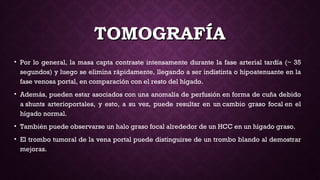 TOMOGRAFÍATOMOGRAFÍA
• Por lo general, la masa capta contraste intensamente durante la fase arterial tardía (~ 35
segundos) y luego se elimina rápidamente, llegando a ser indistinta o hipoatenuante en la
fase venosa portal, en comparación con el resto del hígado.
• Además, pueden estar asociados con una anomalía de perfusión en forma de cuña debido
a shunts arterioportales, y esto, a su vez, puede resultar en un cambio graso focal en el
hígado normal. 
• También puede observarse un halo graso focal alrededor de un HCC en un hígado graso.
• El trombo tumoral de la vena portal puede distinguirse de un trombo blando al demostrar
mejoras.
 