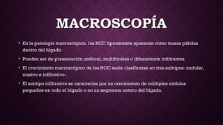 MACROSCOPÍAMACROSCOPÍA
• En la patología macroscópica, los HCC típicamente aparecen como masas pálidas
dentro del hígado.
• Pueden ser de presentación unifocal, multifocales o difusamente infiltrantes.
• El crecimiento macroscópico de los HCC suele clasificarse en tres subtipos: nodular,
masivo e infiltrativo . 
• El subtipo infiltrativo se caracteriza por un crecimiento de múltiples nódulos
pequeños en todo el hígado o en un segmento entero del hígado.
 