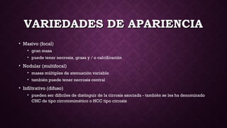 VARIEDADES DE APARIENCIAVARIEDADES DE APARIENCIA
• Masivo (focal)
• gran masa
• puede tener necrosis, grasa y / o calcificación
• Nodular (multifocal)
• masas múltiples de atenuación variable
• también puede tener necrosis central
• Infiltrativo (difuso) 
• pueden ser difíciles de distinguir de la cirrosis asociada - también se les ha denominado
CHC de tipo cirrotomimético o HCC tipo cirrosis
 