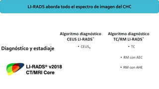 LI-RADS aborda todo el espectro de imagen del CHC
Diagnóstico y estadiaje
 
