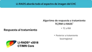 LI-RADS aborda todo el espectro de imagen del CHC
Respuesta al tratamiento
 