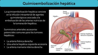 La quimioembolización hepática consiste
en la infusión intraarterial de agentes
quimioterápicos asociada a la
embolización de las arterias nutricias de
la tumoración hepática.
Quimioembolización hepática
Suministros arteriales accesorios
potenciales comunes para los tumores
hepáticos:
• La arteria frénica derecha
• Una arteria hepática izquierda accesoria
• La arteria mamaria interna derecha
 