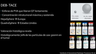 DEB-TACE
 Esferas de PVA que liberan QT lentamente.
 Concentración intratumoral máxima y sostenida
HepaSphere  Europa
QuadraSphere  Estados Unidos
Valoración histológica revela
Histológicamente 70% de las partículas de 100-300nm en
el tumor
Journal of Hepatology 2012 vol. 56 | 908–943
Handbook of Interventional Radiologic Procedures 5th ed.
 
