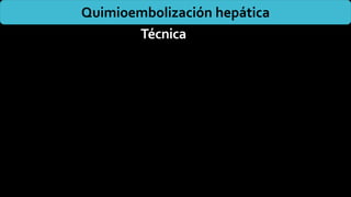 Técnica
Quimioembolización hepática
 