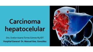 Carcinoma
hepatocelular
Dra. Evelyn AzariaTorres Gómez R3 IDT
Hospital General Dr. Manuel Gea. González
 