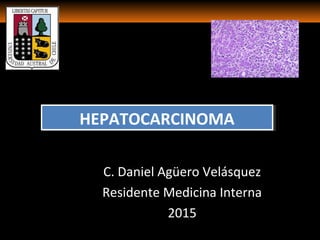 HEPATOCARCINOMAHEPATOCARCINOMA
C. Daniel Agüero Velásquez
Residente Medicina Interna
2015
 