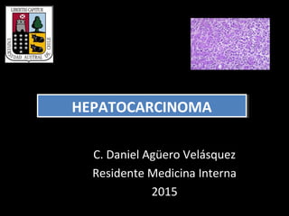 HEPATOCARCINOMAHEPATOCARCINOMA
C. Daniel Agüero Velásquez
Residente Medicina Interna
2015
 