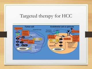 Targeted therapy for HCC
 