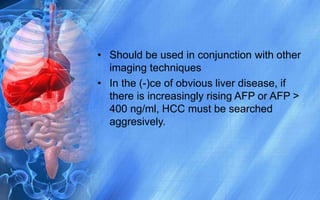 hepatocellularcarcinoma-120228024408-phpapp02 (1).pptx