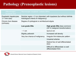 Click to edit Master title style
Shaukat Khanum Memorial Cancer Hospital and Research Centre
Pathology (Preneoplastic lesions)
(Microscopic)
dysplastic foci
Macroscopic dysplastic nodules (DNs)
Dysplastic hepatocytes
(< 1mm size)
Nodular region < 2 cm (diameter) with dysplasia (but without definite
histological criteria of malignancy)
Chronic liver disease
(cirrhosis)
Degree of cytological or architectural atypia
Low grade DNs High grade DNs (less common)
(33 % malignant transformation)
~ 1 cm Up to 2 cm
Slightly yellowish Increased cell density
Very low chance of malignancy Irregular thin-trabecular pattern
Unpaired arteries
Distinct foci of well differentiated
HCC
Difficult to differentiate vs well
differentiated HCC
 