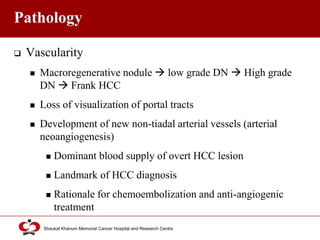 Click to edit Master title style
Shaukat Khanum Memorial Cancer Hospital and Research Centre
Pathology
 Vascularity
 Macroregenerative nodule  low grade DN  High grade
DN  Frank HCC
 Loss of visualization of portal tracts
 Development of new non-tiadal arterial vessels (arterial
neoangiogenesis)
 Dominant blood supply of overt HCC lesion
 Landmark of HCC diagnosis
 Rationale for chemoembolization and anti-angiogenic
treatment
 