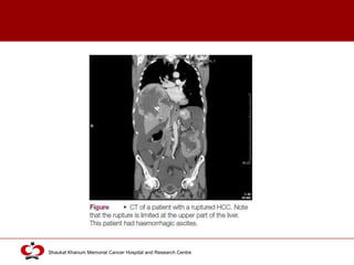 Click to edit Master title style
Shaukat Khanum Memorial Cancer Hospital and Research Centre
 