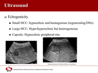 Click to edit Master title style
Shaukat Khanum Memorial Cancer Hospital and Research Centre
Ultrasound
 Echogenicity
 Small HCC: hypoechoic and homogenous (regenerating/DNs)
 Large HCC: Hypo/hyperechoic but heterogeneous
 Capsule: Hypoechoic peripheral rim
 