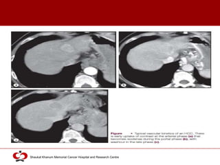 Click to edit Master title style
Shaukat Khanum Memorial Cancer Hospital and Research Centre
 