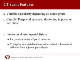 Click to edit Master title style
Shaukat Khanum Memorial Cancer Hospital and Research Centre
CT scan: features
 Variable vascularity depending on tumor grade
 Capsule: Peripheral enhanced thickening in portal or
late phase
 Intratumoral arterioportal fistula
 Early enhancement of portal branches
 Triangular area distal to tumor with contrast enhancement
different from adjacent parenchyma
 