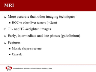 Click to edit Master title style
Shaukat Khanum Memorial Cancer Hospital and Research Centre
MRI
 More accurate than other imaging techniques
 HCC vs other liver tumors (> 2cm)
 T1- and T2-weighted images
 Early, intermediate and late phases (gadolinium)
 Features:
 Mosaic shape structure
 Capsule
 