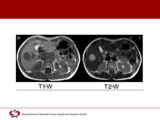 Click to edit Master title style
Shaukat Khanum Memorial Cancer Hospital and Research Centre
 