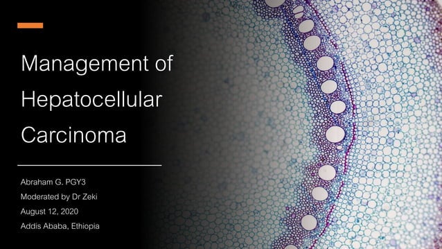 Hepatocellular carcinoma 2020 | PPTX