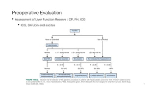 Preoperative Evaluation
• Assessment of Liver Function Reserve : CP, PH, ICG
• ICG, Bilirubin and ascites
29
 