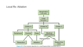 Local Rx: Ablation
40
 
