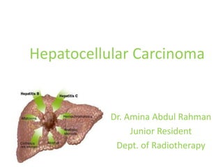 Hepatocellular Carcinoma 
Dr. Amina Abdul Rahman 
Junior Resident 
Dept. of Radiotherapy 
 