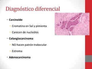 Diagnóstico diferencial
• Carcinoide

  • Cromatina en Sal y pimienta

  • Carecen de nucleólos

• Colangiocarcinoma

  • NO hacen patrón trabecular

  • Estroma

• Adenocarcinoma
 